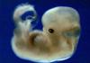 Naisen ja sikiön tila kahdeksannella raskausviikolla Miksi 8. raskausviikolla on iso vatsa?