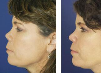 How to make your nose smaller at home: exercises, methods and recommendations