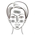 بشرة الوجه جافة جدًا، ما يجب فعله بالعلاجات الشعبية